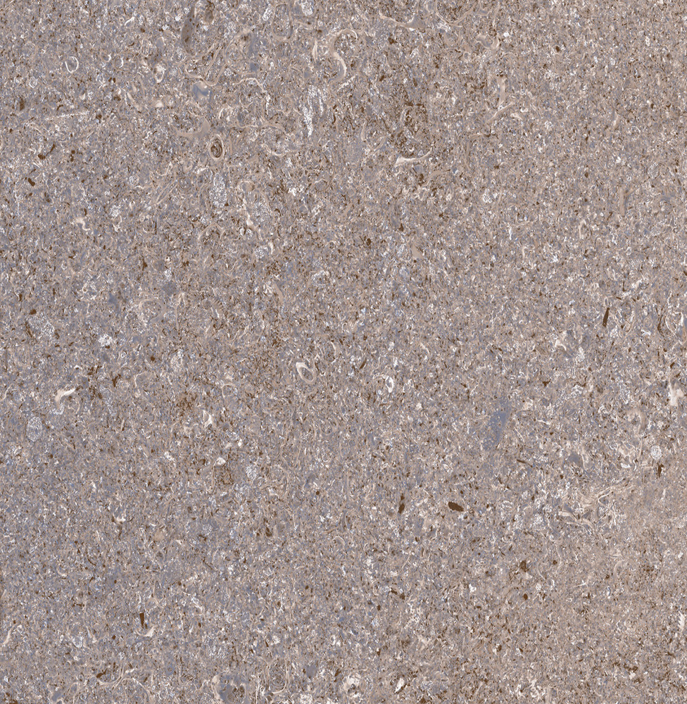 TP413625D На пол Алькон Серый 41x41